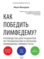Как победить лимфедему?